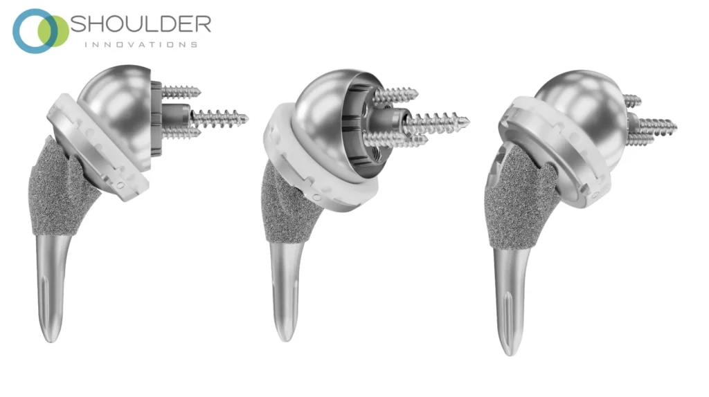 Reverse shoulder replacement implant at multiple angles