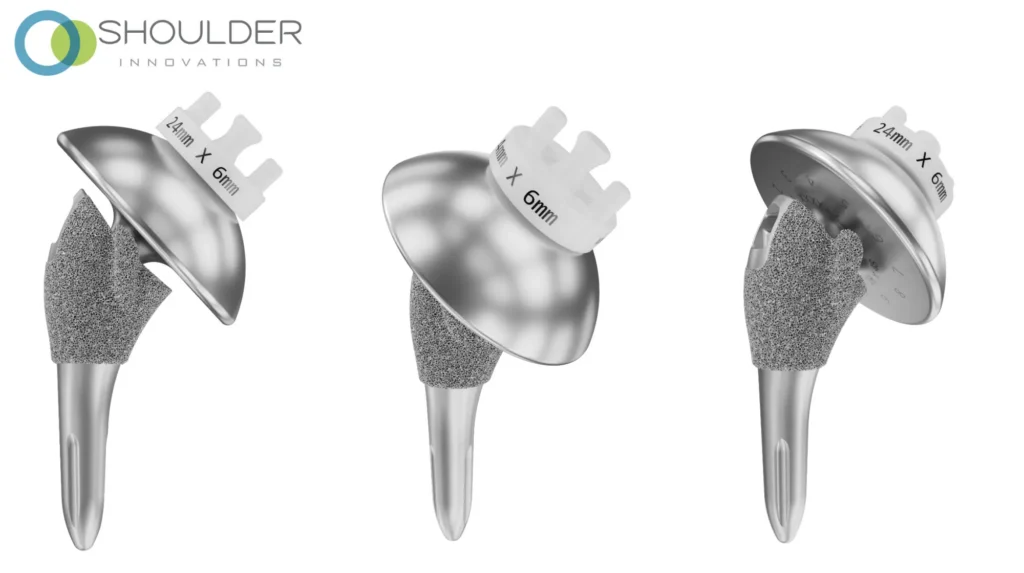 Total shoulder implant from multiple angles